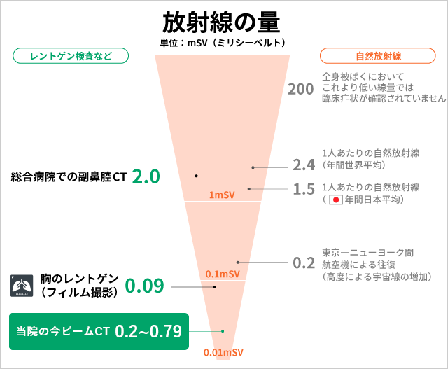 コーンビームCT